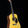 Martin D-28 Billy Strings